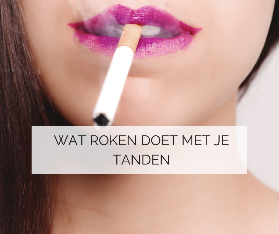 Wat roken doet met je tanden - Silk Laser Studio