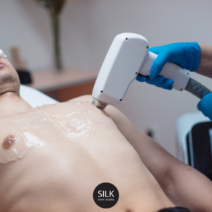 Laserontharing borst buik mannen | Silk Laser Studio